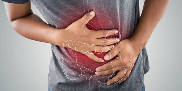 Cancer de colon FOTO Shutterstock jpg