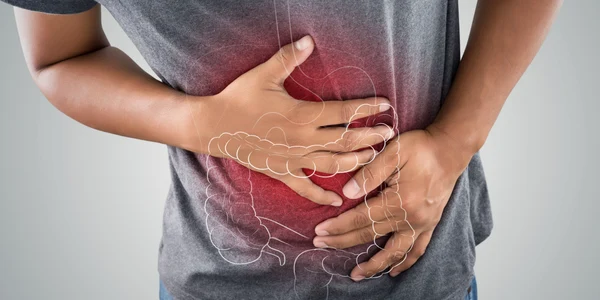 Cancer de colon FOTO Shutterstock jpg