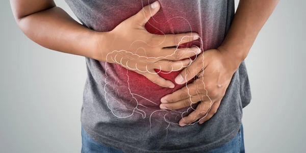 Cancer de colon FOTO Shutterstock jpg