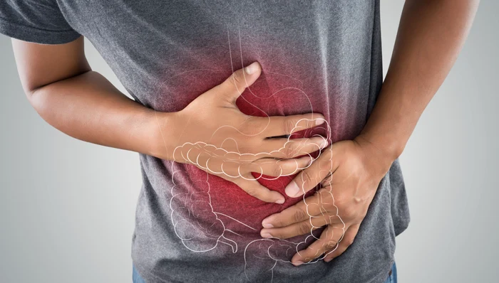 Cancerul de colon este tot mai răspândit în rândul tinerilor FOTO Shutterstock