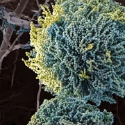 aspergillus fungus scanning electron microscopy 600nw 2558068481 webp
