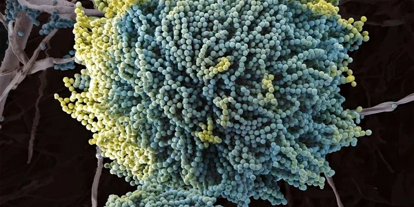 aspergillus fungus scanning electron microscopy 600nw 2558068481 webp