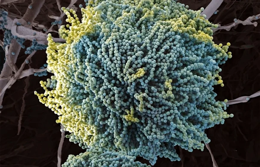 Ciuperca Aspergillus FOTO : Shuterstock