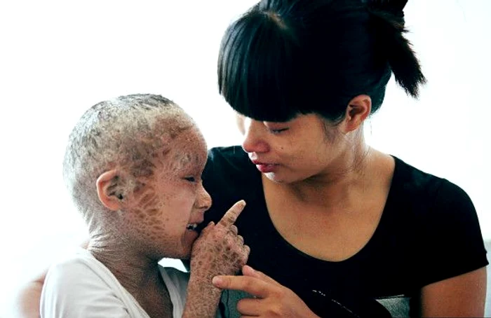 Băiatul peşte (Foto: Imagechina)