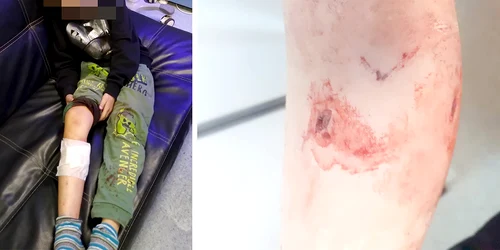 copil muscat caine Murgeni FOTO Vremea Noua jpg