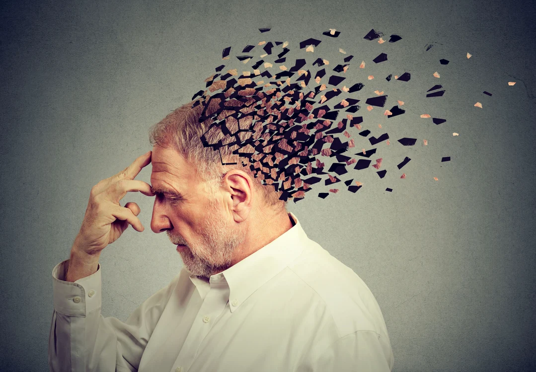 Aproximativ 8.000 de români au fost diagnosticați cu Alzheimer în 2022. FOTO Shutterstock (Arhivă)