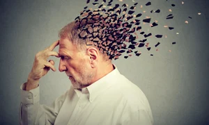Boala Alzheimer FOTO Shutterstock jpg