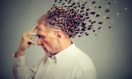 Boala Alzheimer FOTO Shutterstock jpg