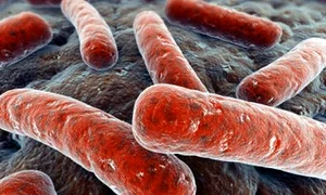 legionella bacteria jpeg