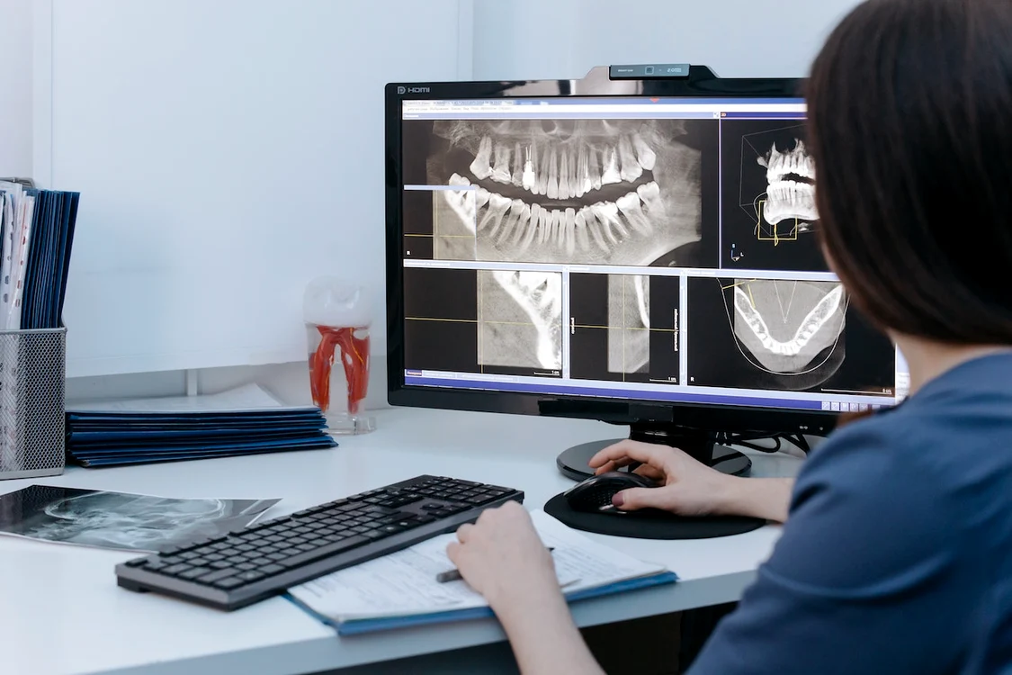 radiografie dentară digitală