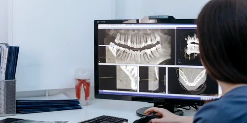 radiografie dentara1 pexels jpg