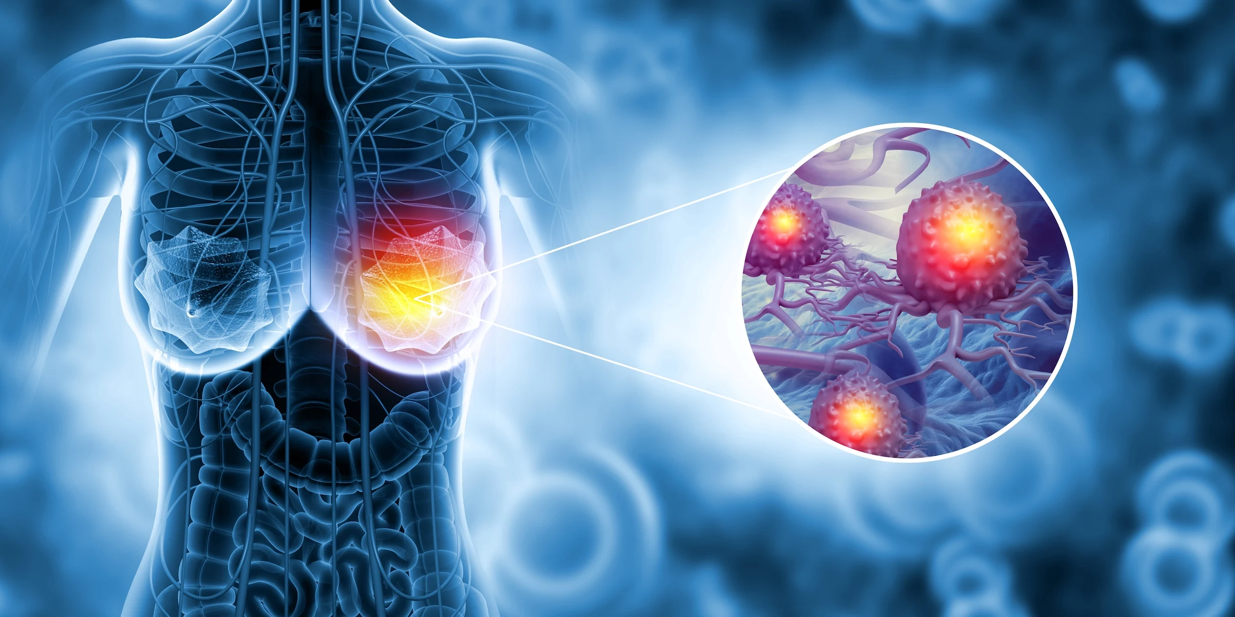 Medic senolog, despre cât de mult contează prevenția și genetica în cancerul la sân. „Mamografia: două minute care pot salva o viață“