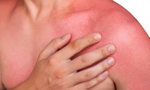 1 arsura solara jpg jpeg