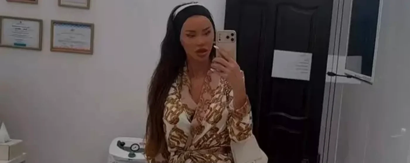 Bianca Drăgușanu și-a mai făcut o intervenție estetică foto: Instagram 