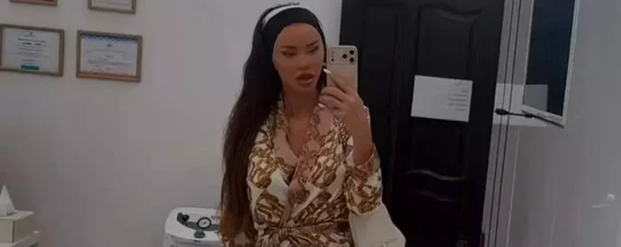 Bianca Drăgușanu și-a mai făcut o intervenție estetică foto: Instagram