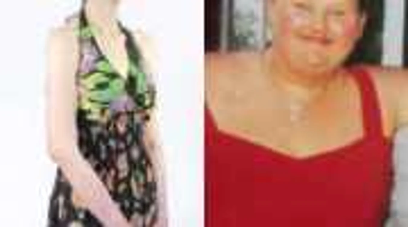 După implantarea inelului gastric, Malissa a început să arate din ce în ce mai rău