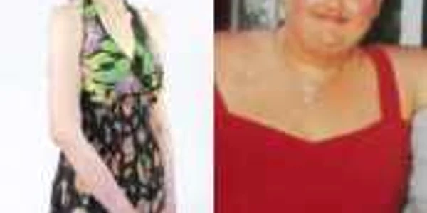 După implantarea inelului gastric, Malissa a început să arate din ce în ce mai rău