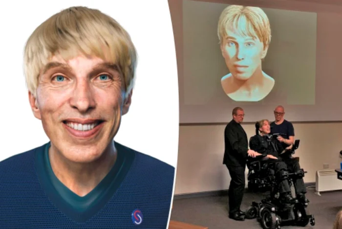Peter Scott-Morgan a trebuit să treacă printr-o serie de operaţii foarte complexe şi riscante pentru a deveni cyborg Foto: Twitter