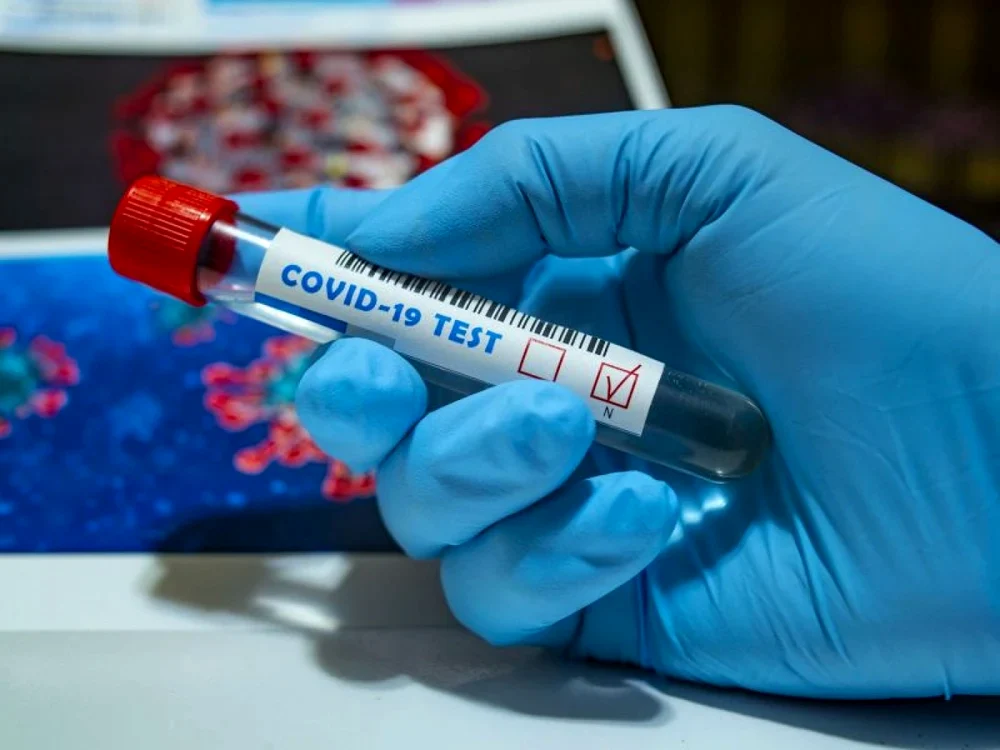 Centrele de evaluare Covid-19 au fost create cu întârziere față de debutul pandemiei