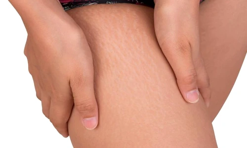 1 vergeturi jpg jpeg