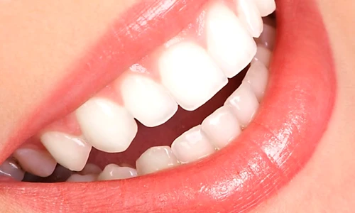 1 70286 original jpg jpeg