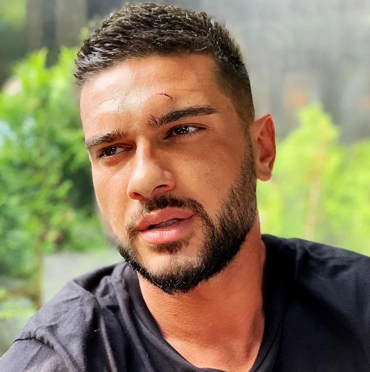Dorian Popa a avut nevoie de îngrijiri medicale şi de trei copci pentru rana de la cap