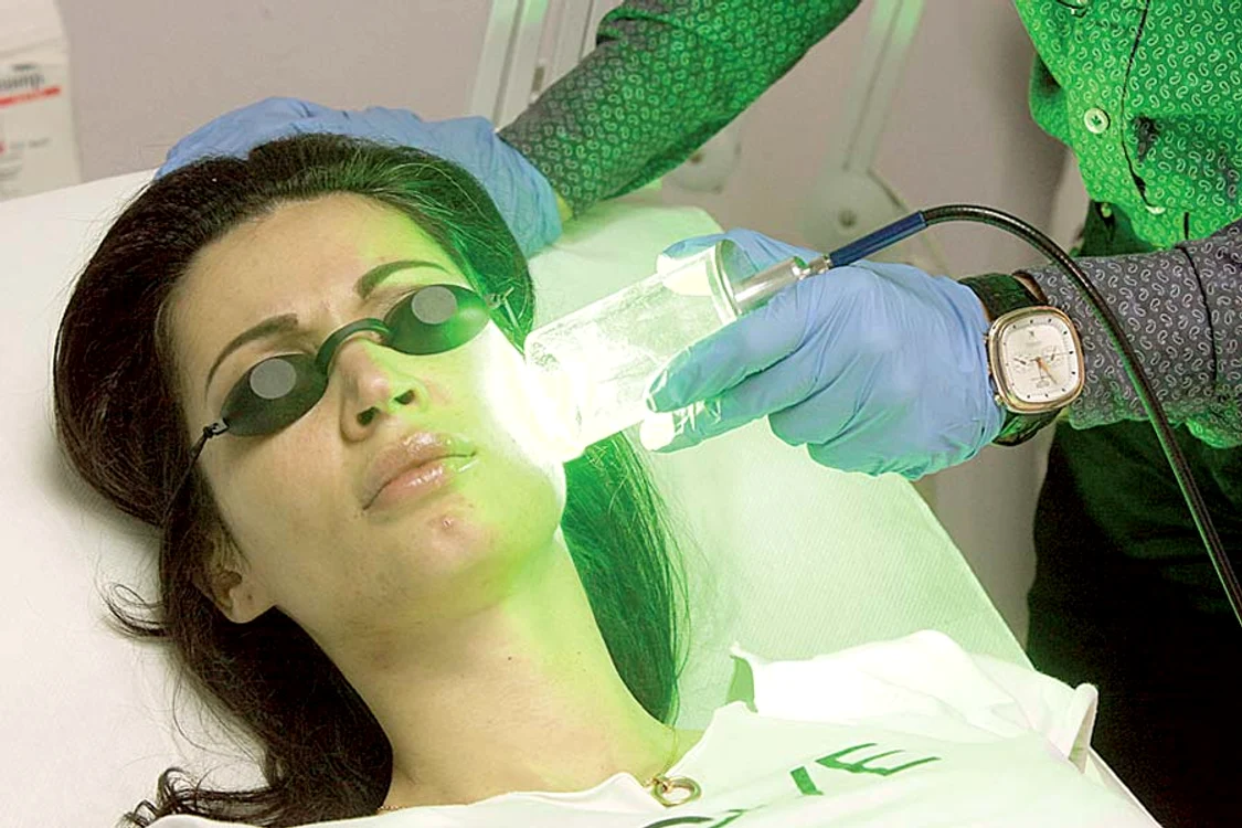Tot ieri, Luciu a suportat  şi un tratament cu laser