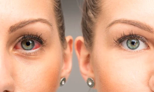 1 shutterstock 642730546 jpg jpeg