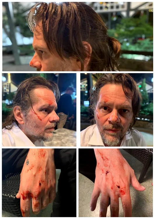 Actorul, în scene sângeroase