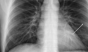 671045330 122184833204939931 8341920870101132293 n jpg