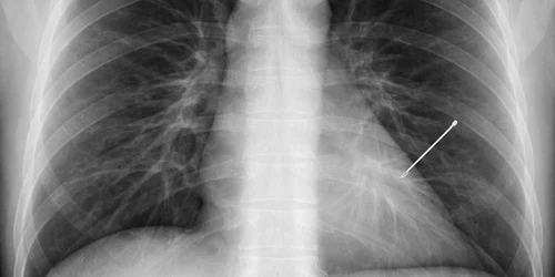 671045330 122184833204939931 8341920870101132293 n jpg