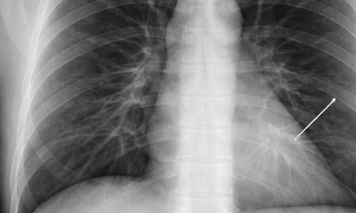 671045330 122184833204939931 8341920870101132293 n jpg