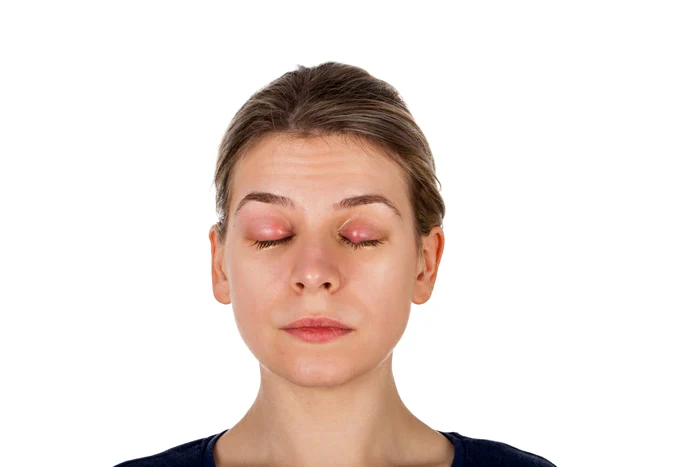 Afecțiuni FOTO Shutterstock