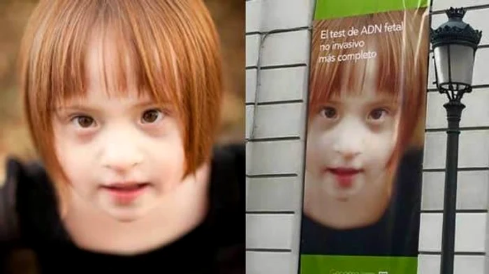 Femeia a fost revoltată atunci când a văzut că fetița ei era imaginea unei campanii de prevenire a nașterii copiilor cu Sindromul Down