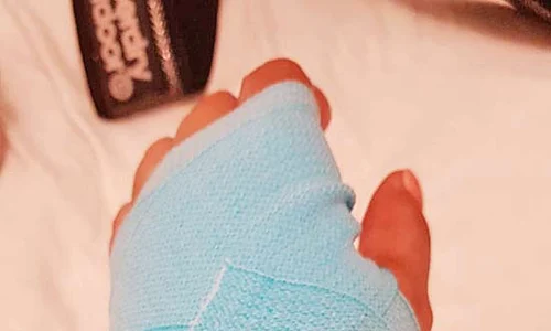 Nicoleta Nicola va purta câteva săptămâni un bandaj elastic jpeg