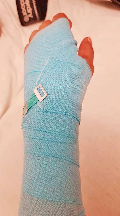 Nicoleta Nicola va purta câteva săptămâni un bandaj elastic