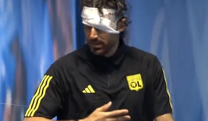 Antrenorul lui Olympique Lyon, rănit înainte de meciul anulat (FOTO: X/fostă Twitter)