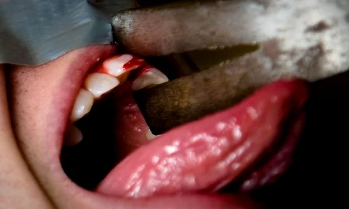 Cele mai înspăimântătoare torturi folosite de a lungul timpului: tehnica macabră care a inspirat o scenă din serialul Urzeala Tronurilor jpeg