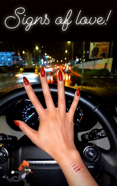 Bianca a publicat urmele lăsate de furculiţa cu care soţul ei a agresat-o