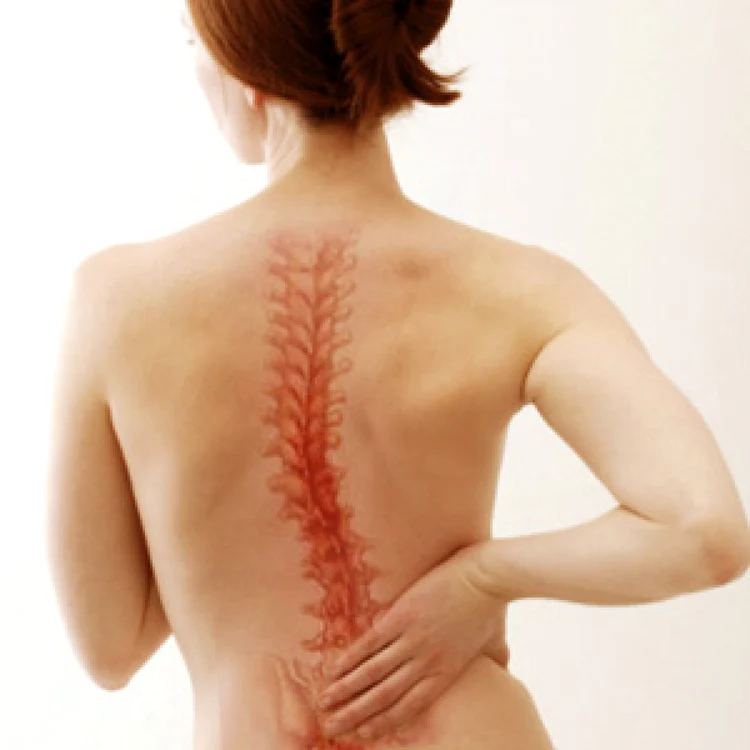 Coloana vertebrală apare ca un stâlp osos, format din 33-34 vertebre FOTO awichitachiropractor.com