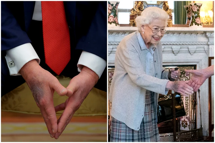Elisabeta și Donald Trump, mâini vinete, Foto GettyImages jpg