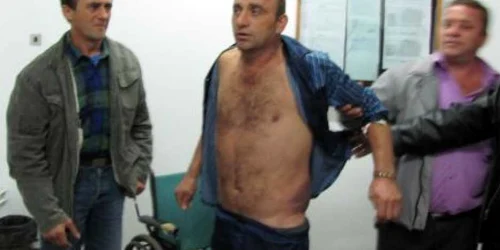 Bărbatul nu a depus încă plângere împotriva poliţiştilor