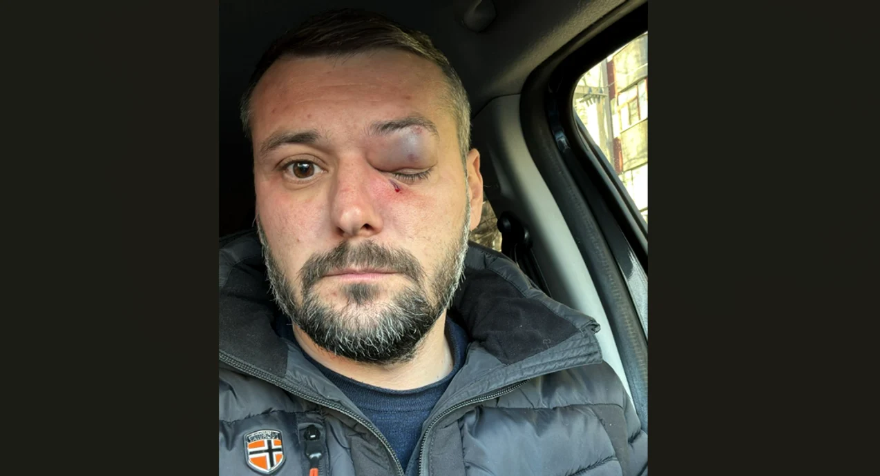 Sabin Bratu ar fi fost agresat în fața unei secții de votare din Slatina FOTO: captura FB/PSD Olt