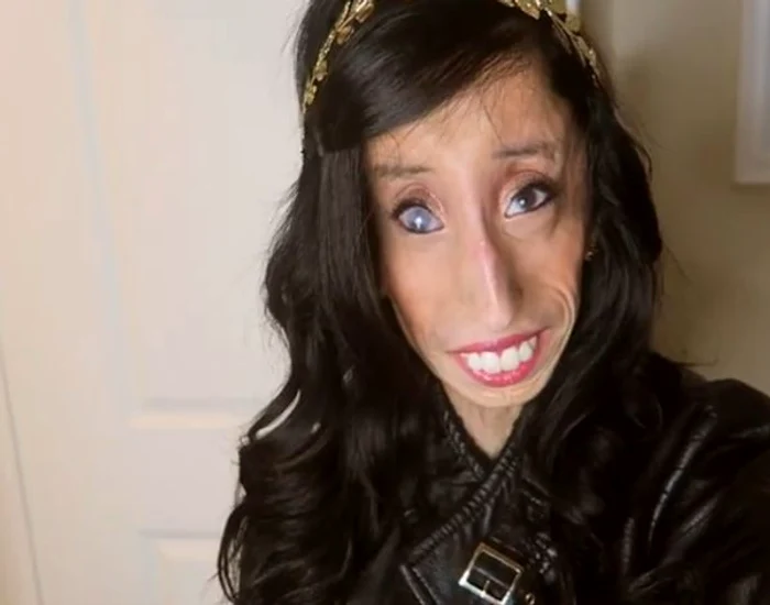 Lizzie Velasquez cântăreşte doar 27 de kilogrameFoto: Captura Youtube