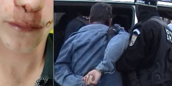 Tânărul care pretinde că a fost bătut de poliţişti FOTO Liliana Marusac/Facebook/Arhivă
