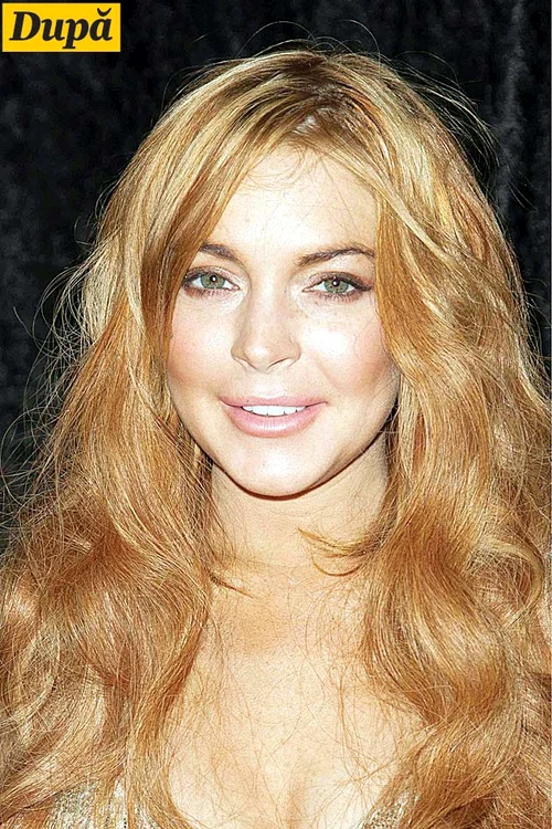 La nici 20 de ani, Lindsay Lohan  (27 de ani) şi-a făcut nenumărate  injecţii cu botox, în perioada  în care avea probleme cu legea