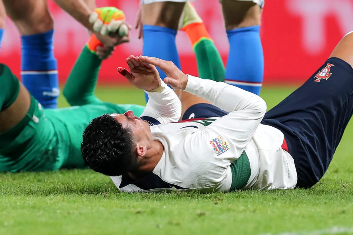 Ronaldo, cu nasul spart în partida Cehia - Portugalia FOTO EPA EFE