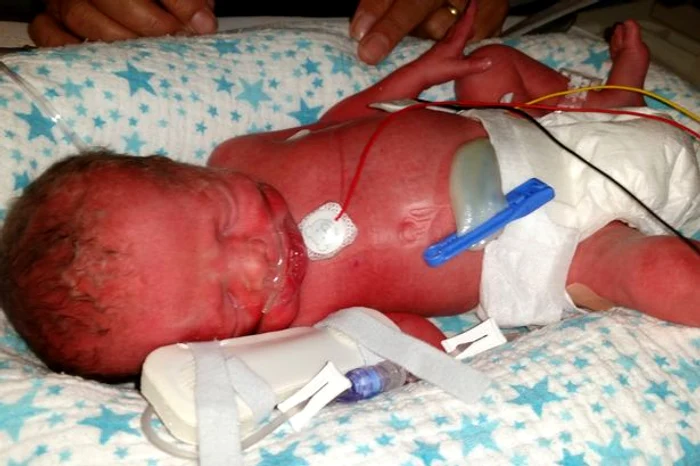 Jasmine a fost născută cu 10 zile mai devreme