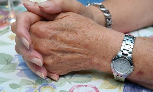 1 cum scapi de petele de pe maini cele mai bune metode twg5 jpg jpeg