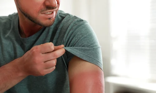 ghid ingrijire piele dupa plaja jpg